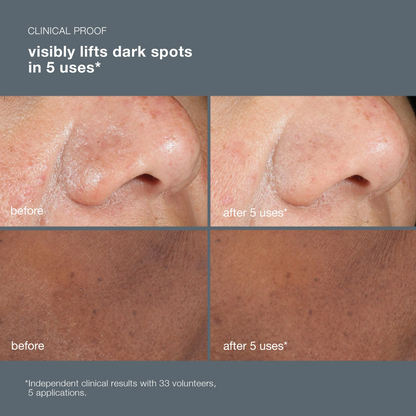 powerbright dark spot peel